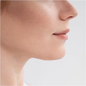 Belkyra/Kybella Fast and Effective