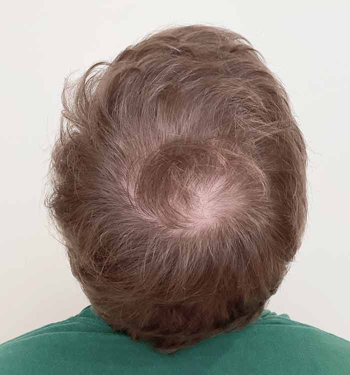 Male 32 before
