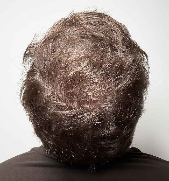 Male 32 after