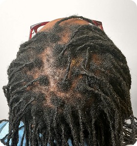 Female 56 after