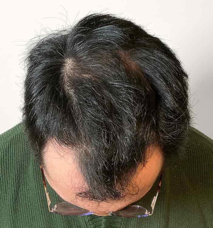 Male 30 after