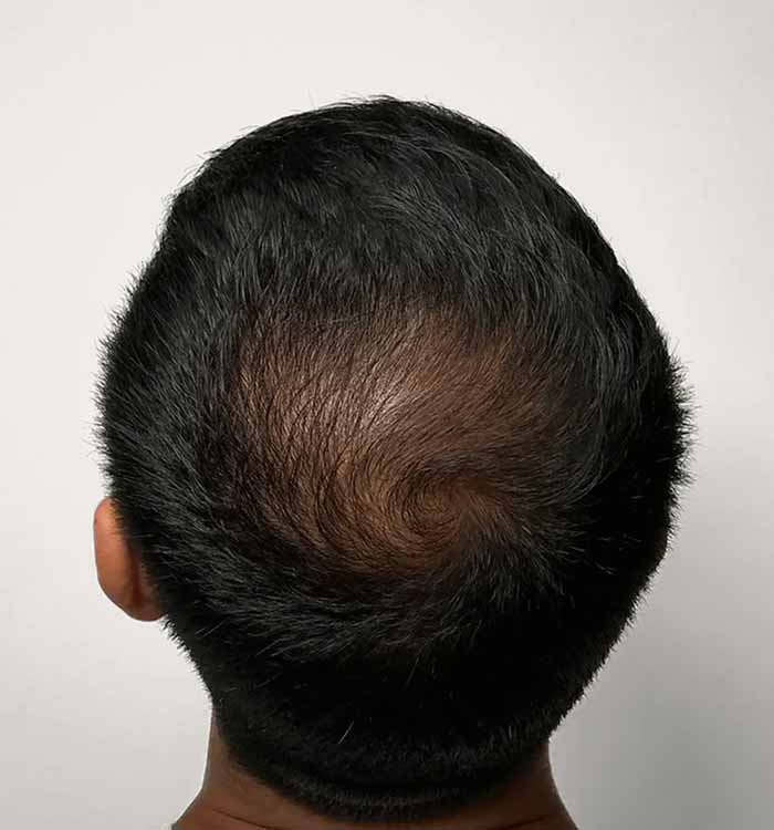 Male 31 after