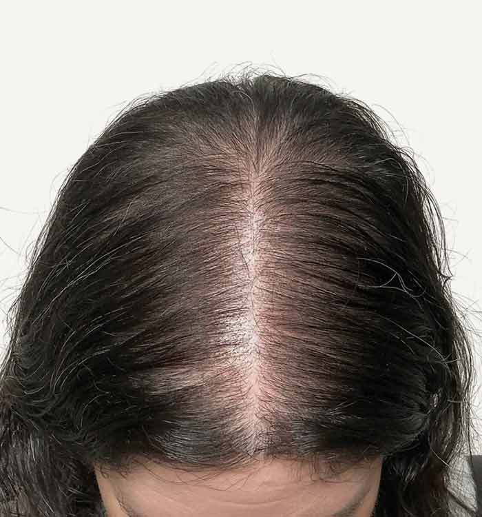 Female 49 after