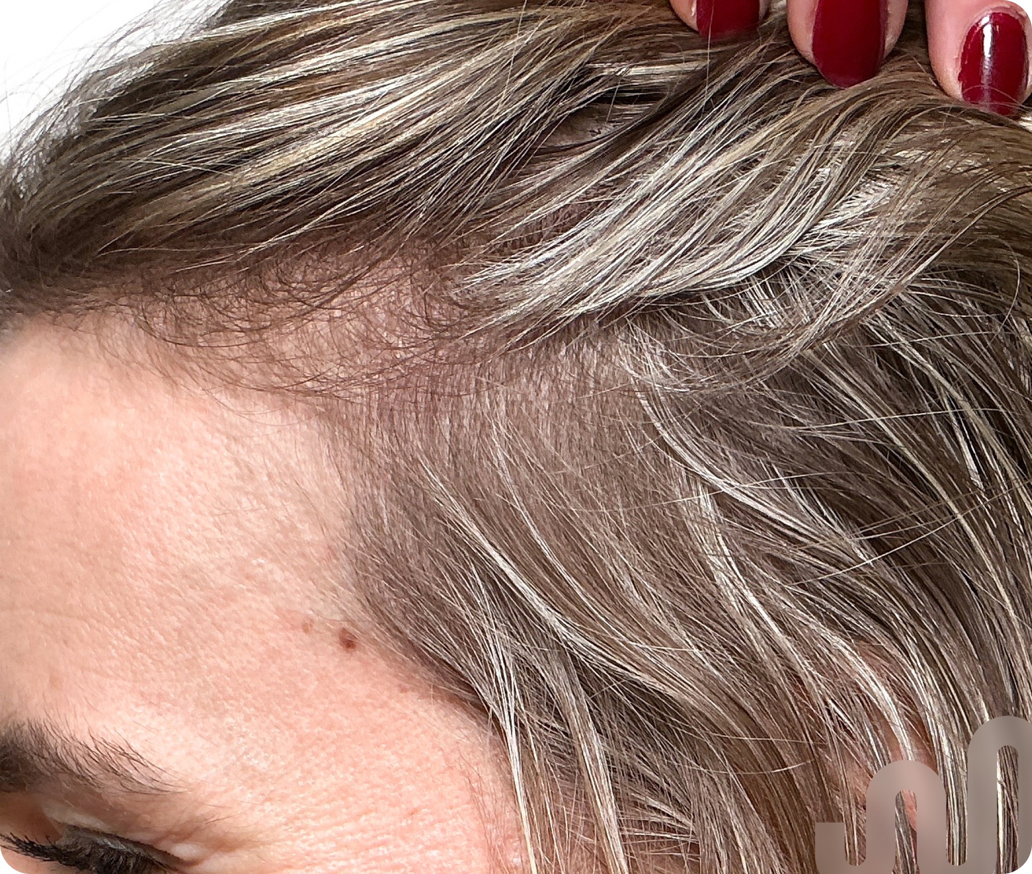 Female 33 after