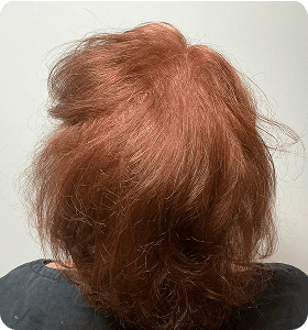 Female 52 after